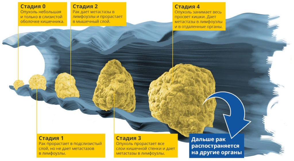 CRC dynamic